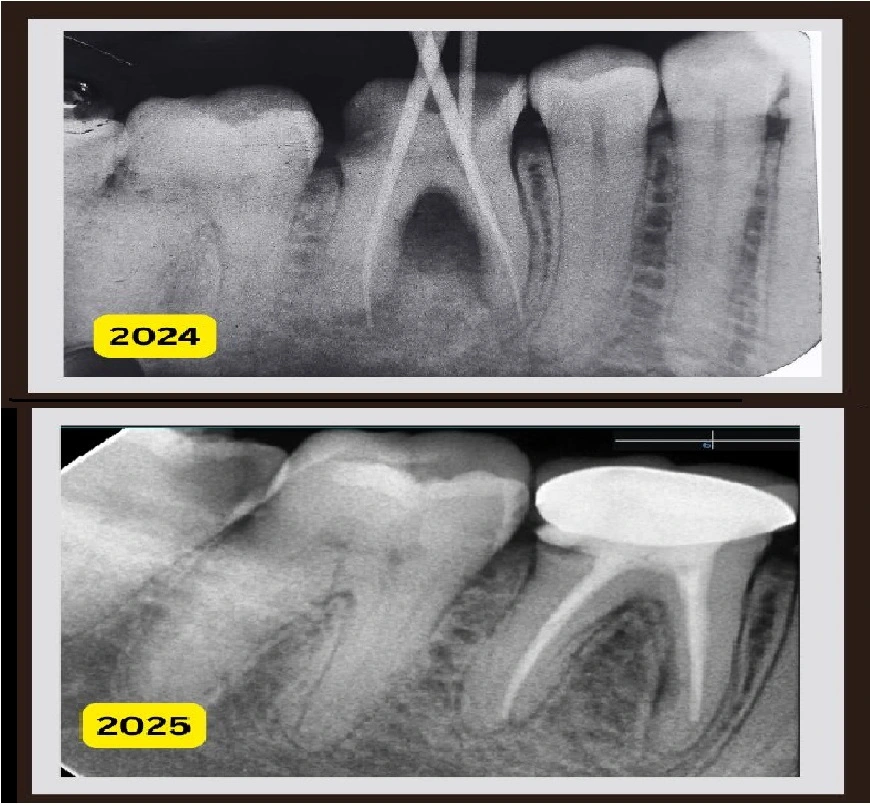 Dental Check-Up